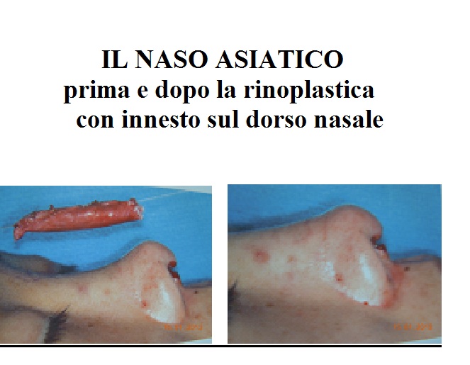 Leliminazione di pigmentary nota in Almaty